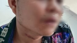 Penasehat Hukum AS Minta Kliennya Segera Dikontrol Dokter Spesialis Jiwa