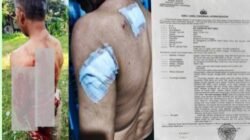Penganiayaan Berat di Caringin Bogor: Wilson Lalengke Kecam Aksi Main Hakim Sendiri, Desak Polisi Usut Tuntas Terduga Pelaku ‘Imron’*