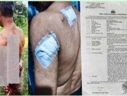 Penganiayaan Berat di Caringin Bogor: Wilson Lalengke Kecam Aksi Main Hakim Sendiri, Desak Polisi Usut Tuntas Terduga Pelaku ‘Imron’*
